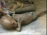 Millones de personas están muriendo de hambre en el mundo