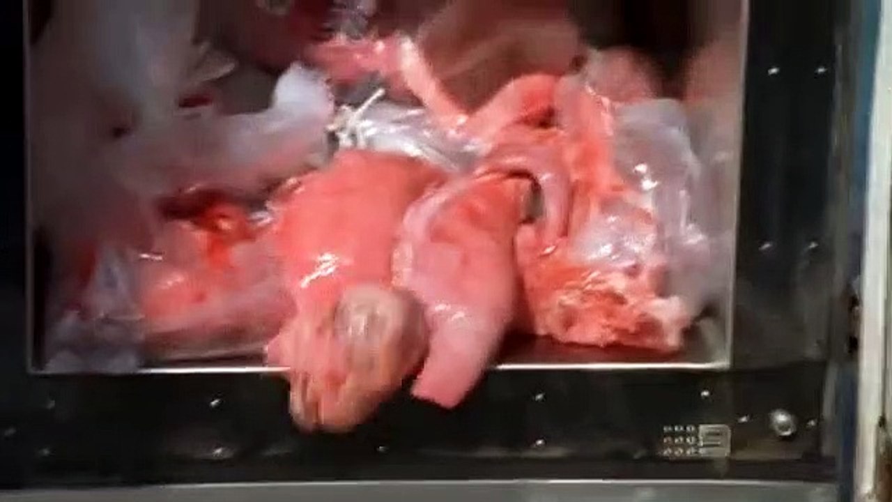 Sea Patrol 4x08 The Universal Donor