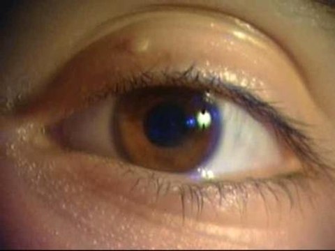 Detectan una nueva forma de consumir los 'tripis', por vía ocular