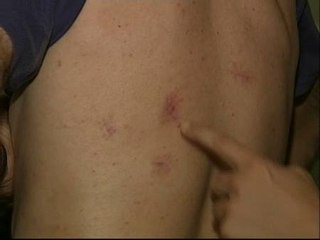 Salva la vida tras recibir 25 puñaladas