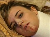 Una joven de Jaén sobrevive a la brutal paliza de su ex novio