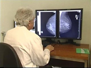 Aumenta su incidencia pero también la supervivencia al cáncer