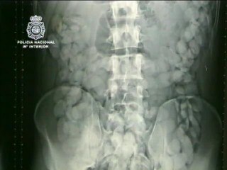 Con 270 &#039;bellotas&#039; de hachís en el cuerpo