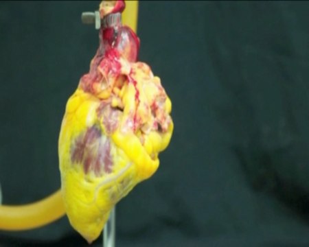 Buscan alternativas al transplante de corazón