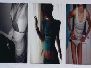 La policía lucha contra las web pro-anorexia