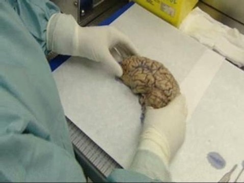 Cerebros para mejorar vidas