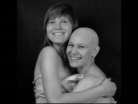 Una exposición reivindica la belleza de mujeres que han sufrido cáncer