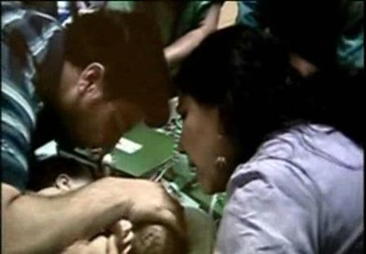 Separan a dos siamesas de 10 meses en Chile