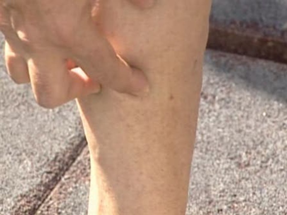 Vecinos de Valencia conviven con pulgas y mugre