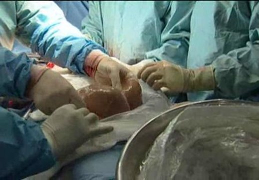 España está a la cabeza de donantes del mundo