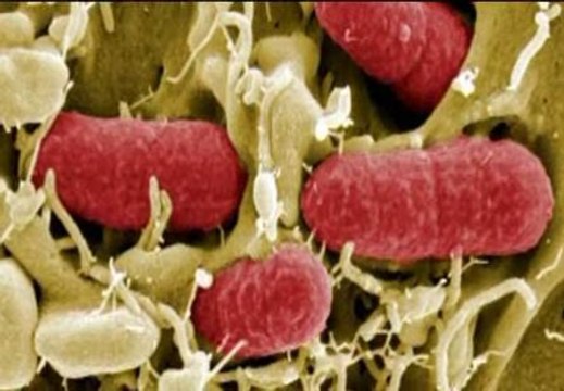 Los expertos descartan que la bacteria E.Coli pueda propagarse a otros países