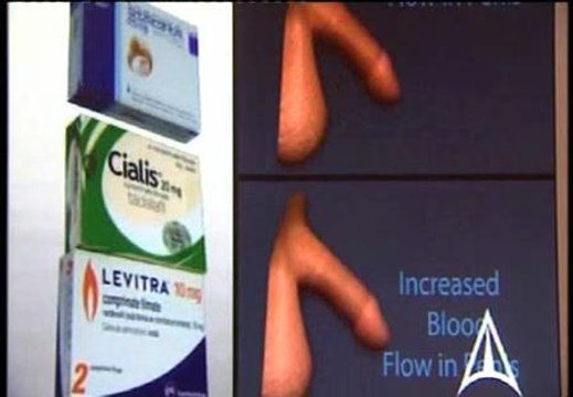 La disfunción eréctil puede ser un síntoma de furutos problemas del corazón