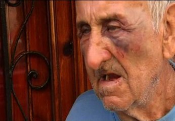 Anciano apaleado por dos ladrones en su propio domicilio