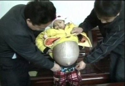 Una enfermedad muy rara