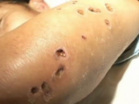 Al menos 41 muertos tras ataques de avispas gigantes