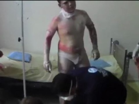 Denuncian presunto uso de napalm contra una escuela en Siria