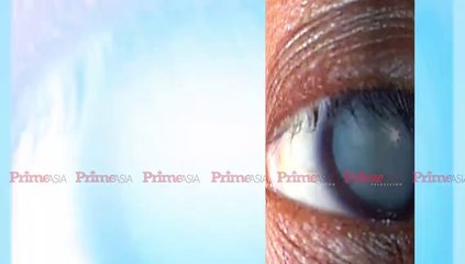 Cataract Surgery-Akal Eye Hospital