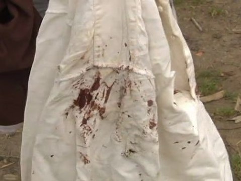 Una explosión de petardos hiere a los miembros de un grupo de música en La Coruña