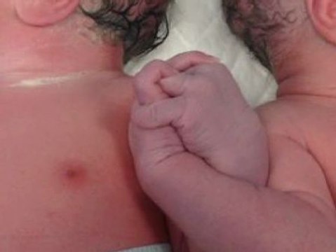 El ginecólogo que atendió a los mellizos de la foto habla de una conexión especial entre ellos