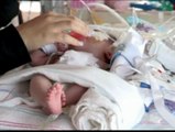 Una niña de tres meses salva la vida pese a nacer con el corazón fuera