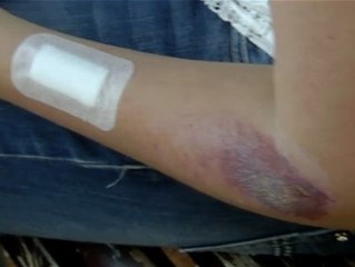 Agresión a una mujer transexual en Valencia