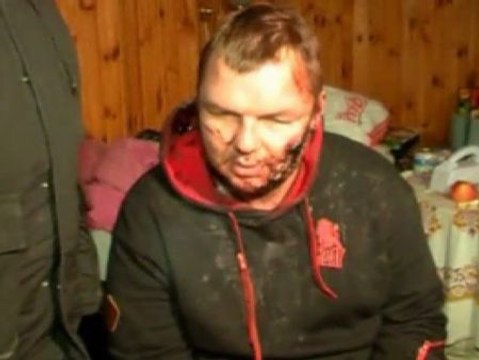 Torturan a un opositor ucraniano : Tengo agujeros en las manos, me crucificaron