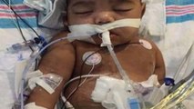 Un hospital en EEUU retrasa un trasplante de riñón a un niño porque su padre tiene problemas con la justicia
