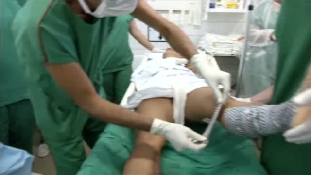 Doctores en Brasil usan piel de peces para tratar las quemaduras