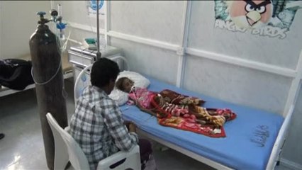 La pequeña Jamila fallece en el hospital víctima de la guerra en Yemen.