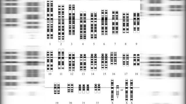 Las '21 razones' de Madeline Stuart sobre la pasarela