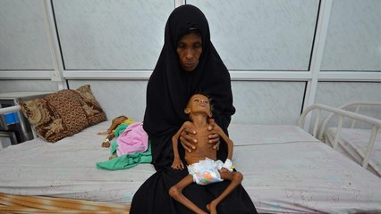 113 مليون جائع بالعالم حسب منظمات دولية