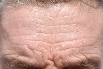 6 astuces naturelles contre les rides