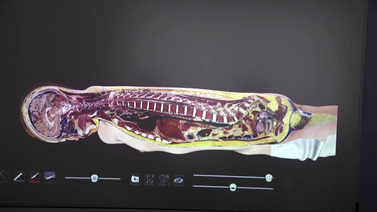 Dissection virtuelle !