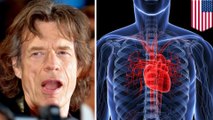 Mick Jagger to get heart valve replacement surgery