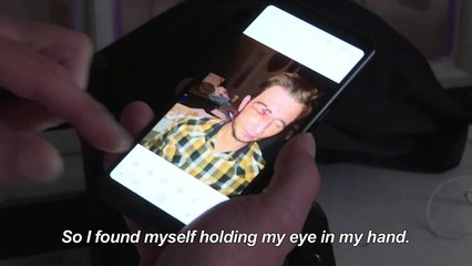 Maimed protesters question French police methods (2/5)