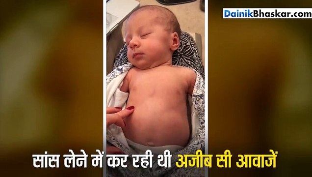 सोती हुई बच्ची से सांस लेने के दौरान आ रही थी अजीब सी आवाज