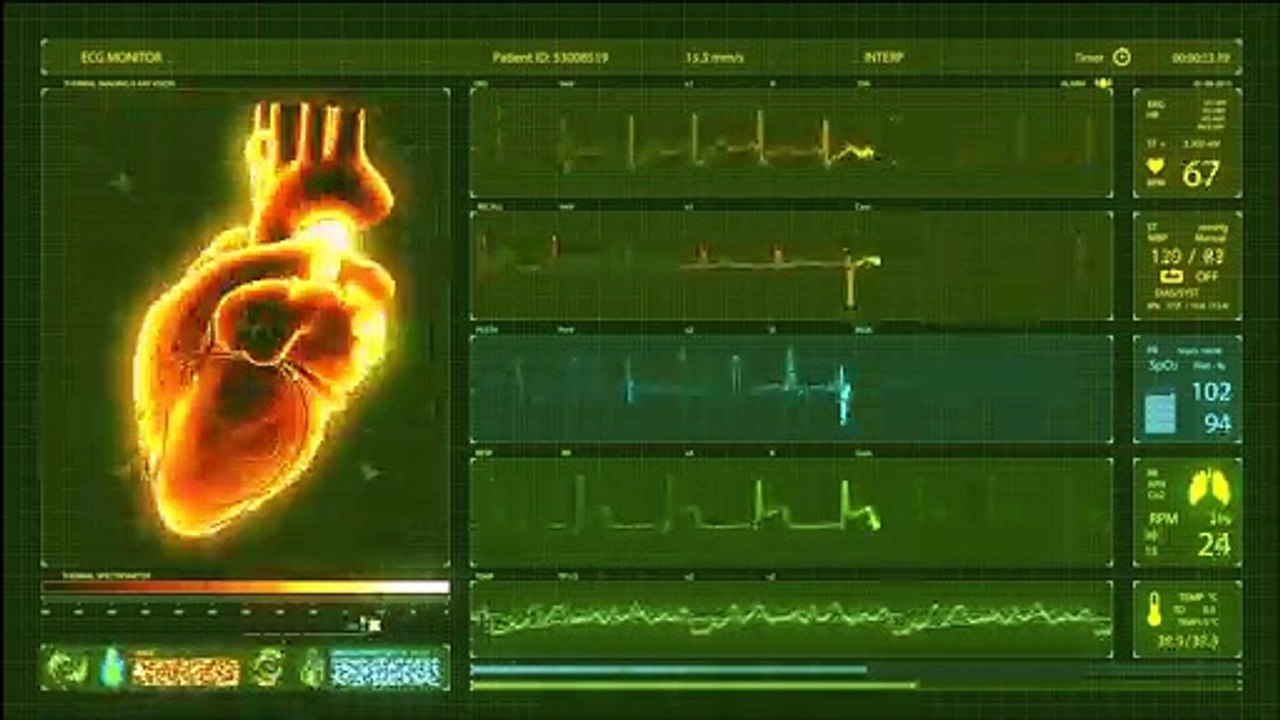 COEUR