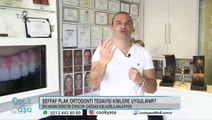 Lamine ile Estetik Gülüş Tasarımı