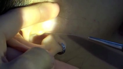 진천출장안마 #P# 후불100%ョ｛Ø7Ø↔8782↔38ØØ카톡FK88｝진천전지역출장마사지진천출장안마진천출장마사지'만족♠출장오피걸출장모텔'출장만남