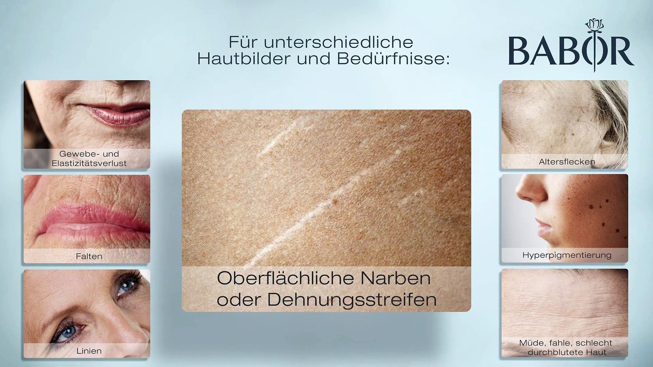Film über die Wirkungsweise der Microdermabrasion