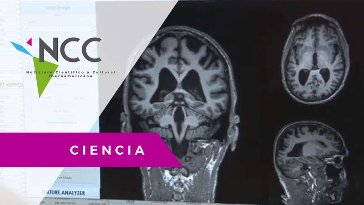 ALTEA, un software que detecta el alzhaimer.