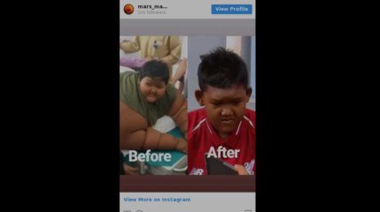 Arya Permana, qui fut considéré comme «Le garçon le plus gros du monde», a fait régime: sa transformation est stupéfiante