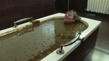 Crude oil baths a controversial ‘cure’ in Azerbaijan