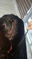 Porex Hair Diyarbakır Saç Protez Merkezi