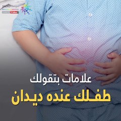 فيديو معلوماتى.. أعراض ديدان البطن عند الأطفال