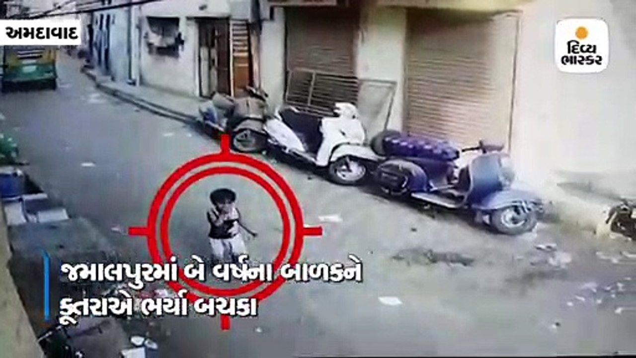 જમાલપુરમાં બે વર્ષના બાળકને કૂતરાએ બચકા ભર્યા,...