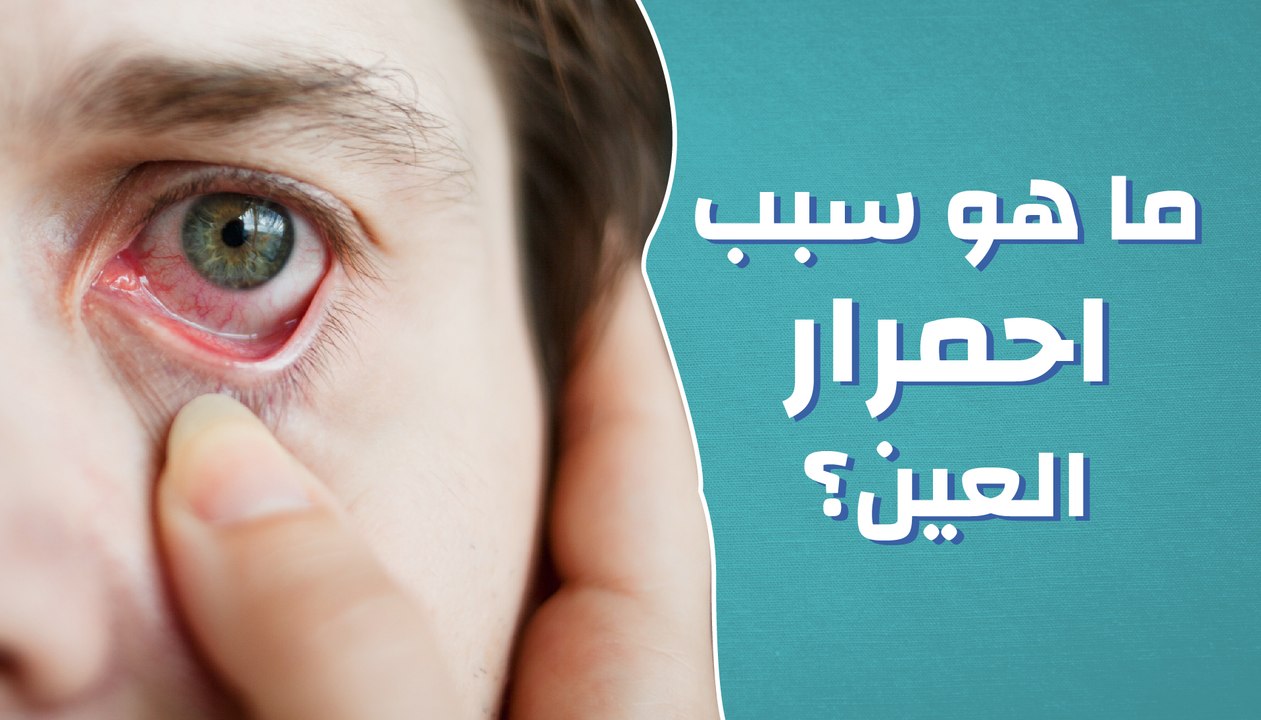 ما هو سبب احمرار العين؟ - فيديو Dailymotion