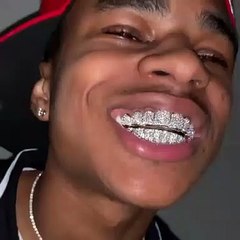 YBN Almighty Jay shows off new diamond platinum grill