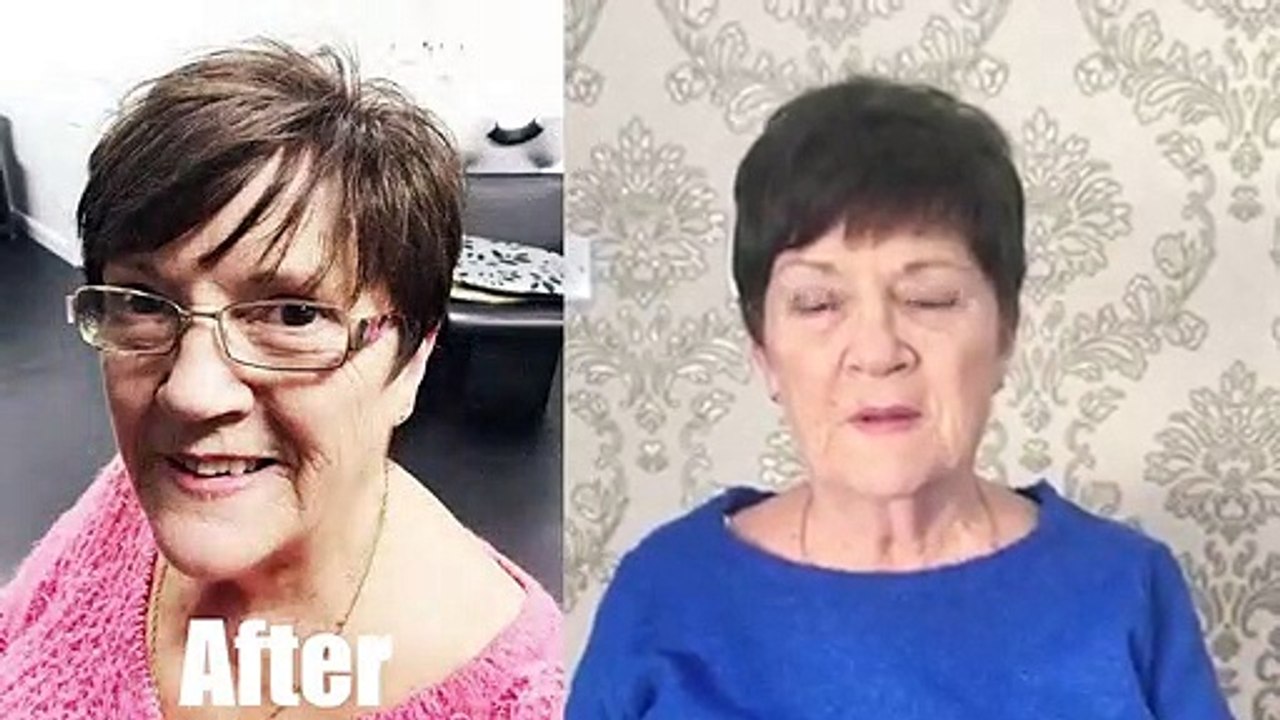 Hair System Review- 'The Best My Hair Has Ever Looked' - Lordhair