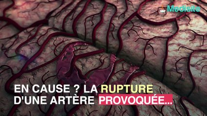 AVC : s'étirer le cou peut le provoquer !